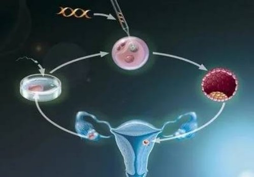 什么是繼發性宮縮乏力,繼發性宮縮乏力的原因有哪些